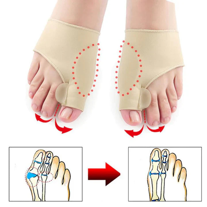 Hallux-Valgus-Korrekturschutz (1 Paar)